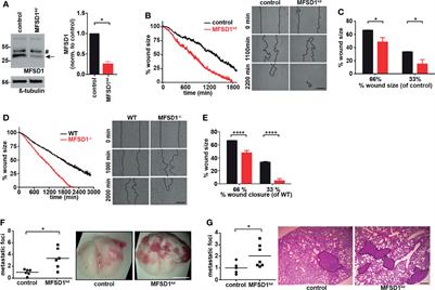 Frontiers | The Solute Carrier MFSD1 Decreases the Activation